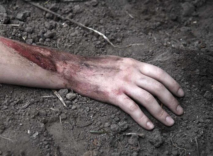 2264420079 featured image Injured arm partially buried in dirt