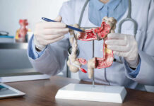Doctor pointing at anatomical model of the colon.