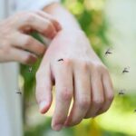 hand being bitten by mosquitoes outdoors
