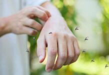 hand being bitten by mosquitoes outdoors