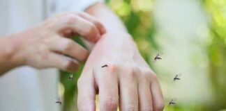 Fatal Dengue Case Raises Concern in Tampa hand being bitten by mosquitoes outdoors